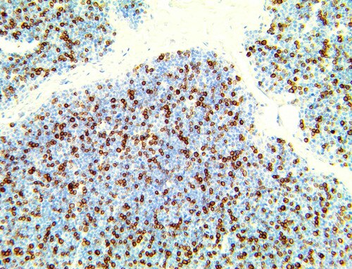IHC of TCR Beta on an FFPE Thymus Tissue